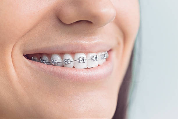 Best Veneers and Lumineers  in Alburtis, PA
